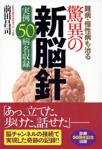 肩こりの画像